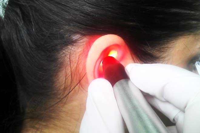 Uso do Laser em Otorrinolaringologia e Cirurgia de Cabeça e Pescoço