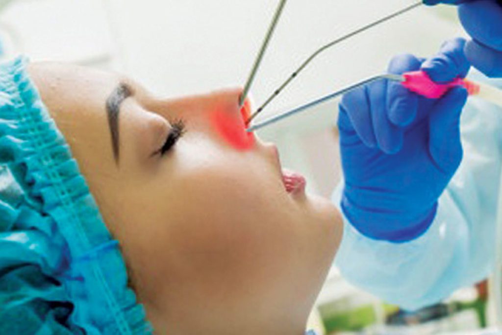 Uso do Laser em Otorrinolaringologia e Cirurgia de Cabeça e Pescoço